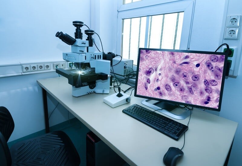 Frost Radar –Which Best Practices Drive Growth in Digital Pathology?